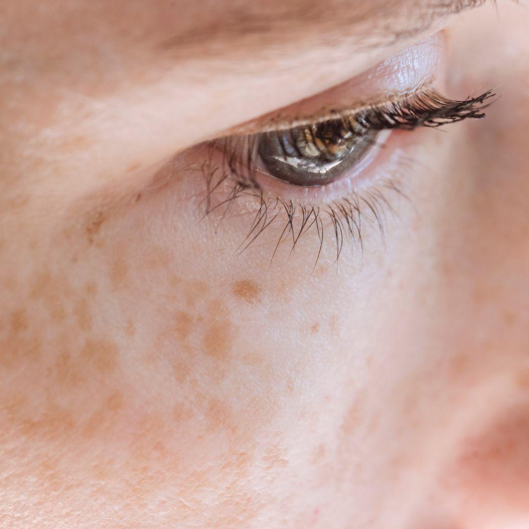 Tattooed freckles - the beauty trend of 2022